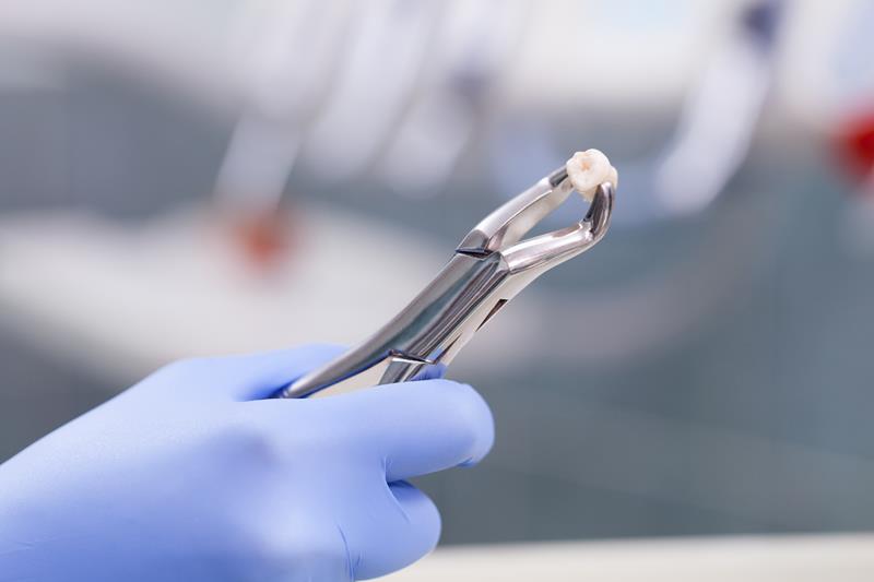 Tooth extraction evaluation at Flex Dental in Tampa, Florida
