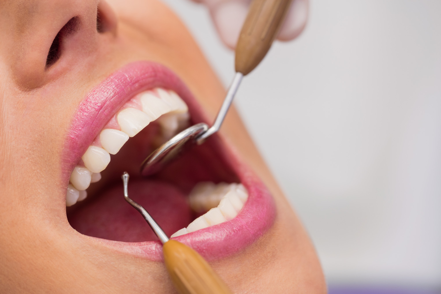 Periodontal gum health evaluation at Flex Dental in Tampa